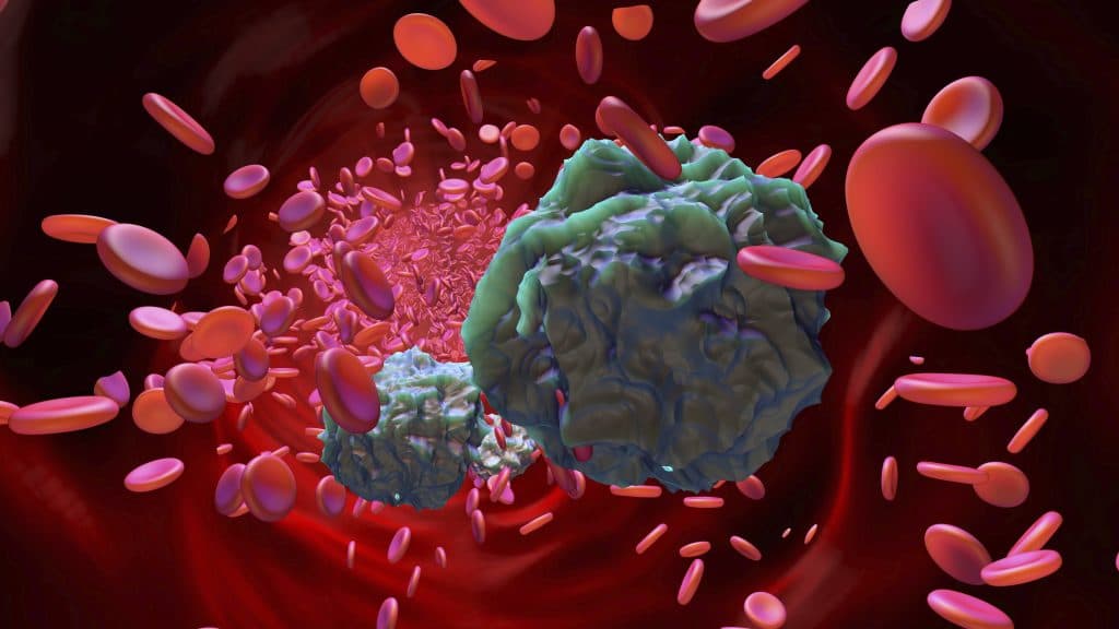 leukemia